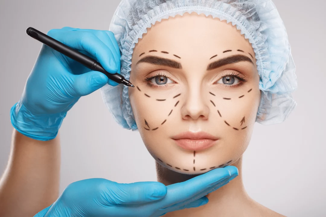 portrét ženy, na které naznačují, kde bude provedena plastická chirurgie 