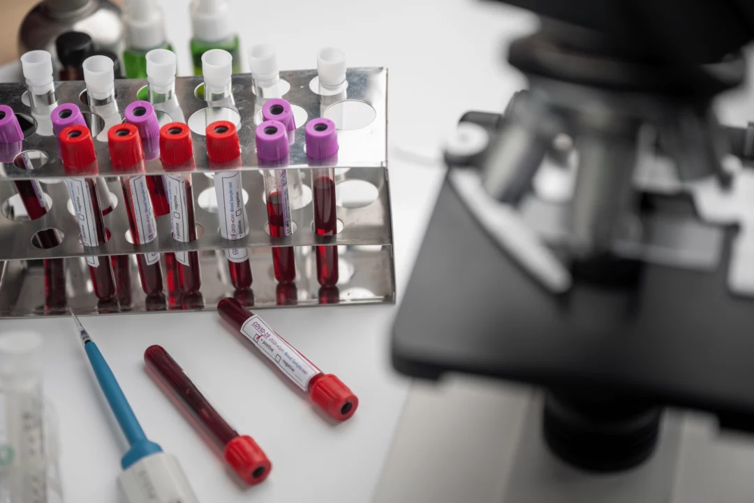 Laboratorní zkumavky s krví na stojanu, mikroskop a pipeta na bílém stole v medicínské laboratoři.